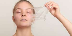 Chemical Peels treatment