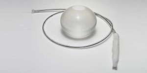 gastric ballooning