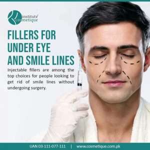 fillers-under-eye